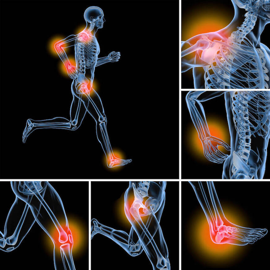 cbd-contre-arthrose-arthriste